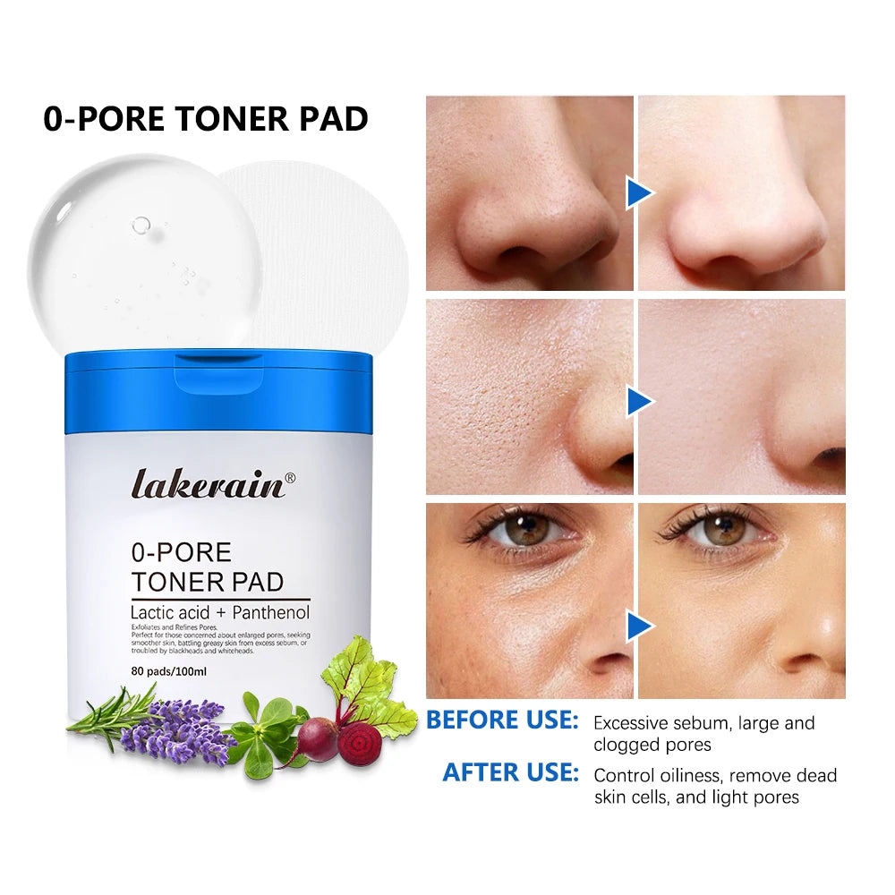 Refreshing Pore Toner Pads – Cleanse & Refresh Your Skin ✨