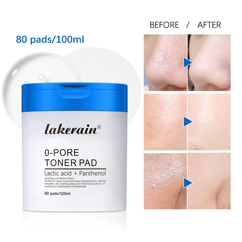 Refreshing Pore Toner Pads – Cleanse & Refresh Your Skin ✨