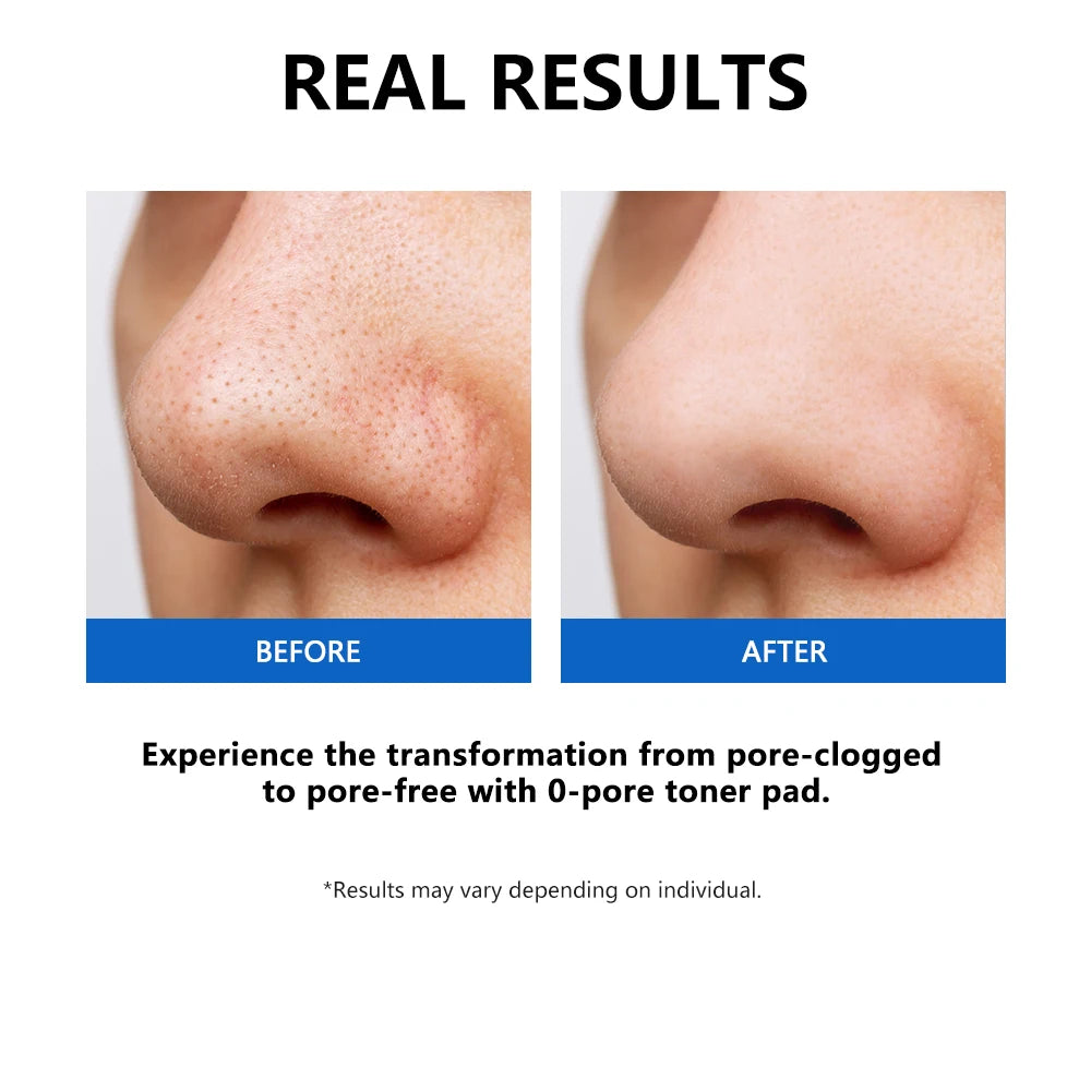 Refreshing Pore Toner Pads – Cleanse & Refresh Your Skin ✨